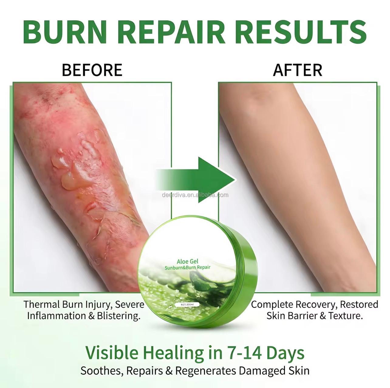Aloe Vera Gel
